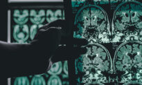 A Single Brain Scan Could Diagnose Alzheimer’s Disease