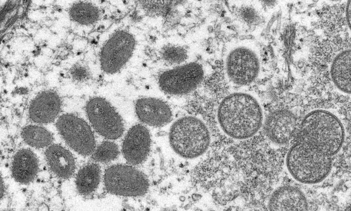 An electron microscopic (EM) image shows mature, oval-shaped monkeypox virus particles as well as crescents and spherical particles of immature virions, obtained from a clinical human skin sample associated with the 2003 prairie dog outbreak in this undated image obtained by Reuters on May 18, 2022. (Cynthia S. Goldsmith, Russell Regnery/CDC/Handout via Reuters)