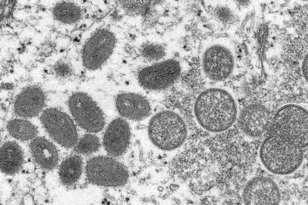 Mature, oval-shaped monkeypox virus particles as well as crescents and spherical particles of immature virions, obtained from a clinical human skin sample associated with the 2003 prairie dog outbreak, in an undated photo obtained by Reuters, on May 18, 2022. (Cynthia S. Goldsmith, Russell Regnery/CDC/Handout via Reuters)