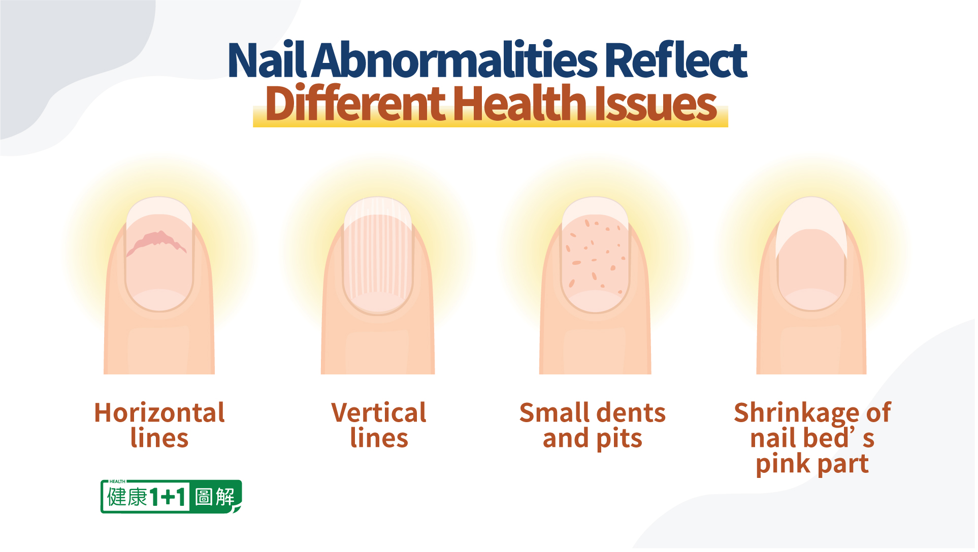 8 Nail Conditions and What They Mean for Your Health