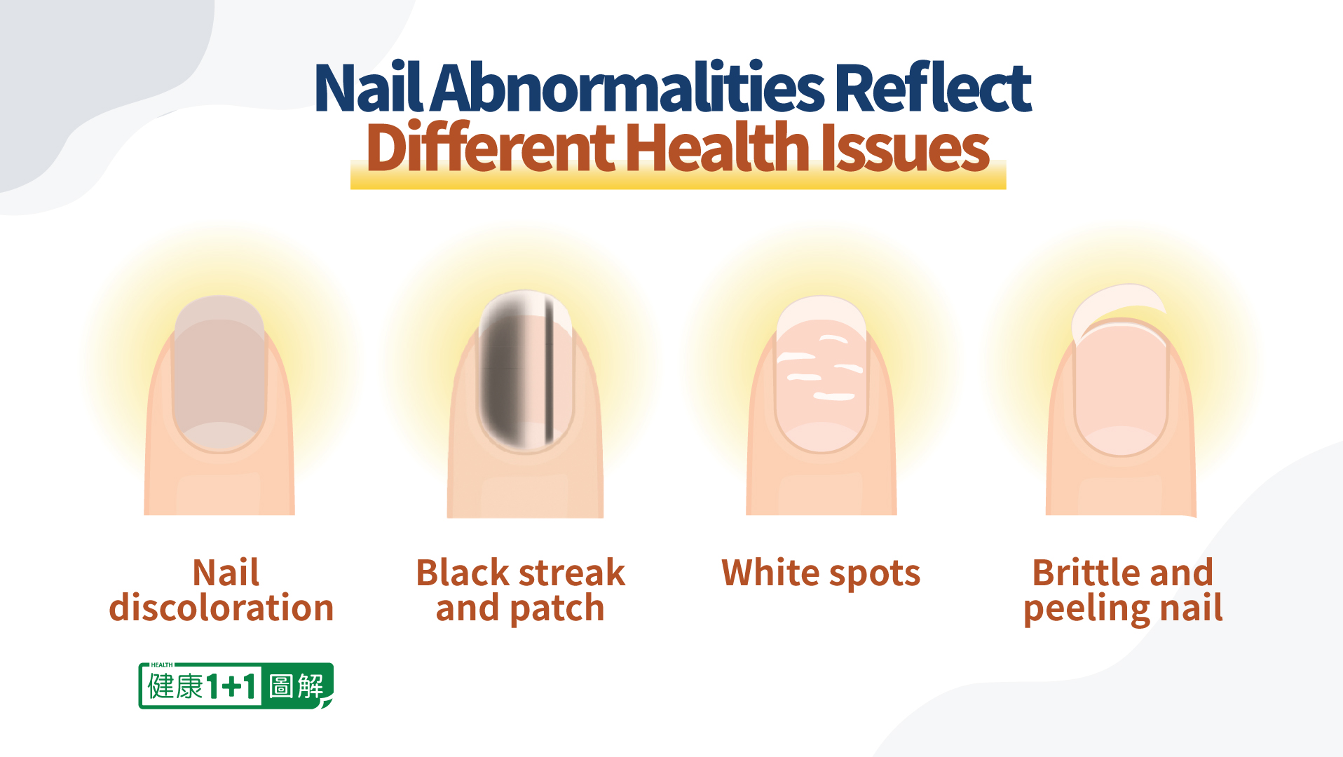 8 Nail Conditions and What They Mean for Your Health