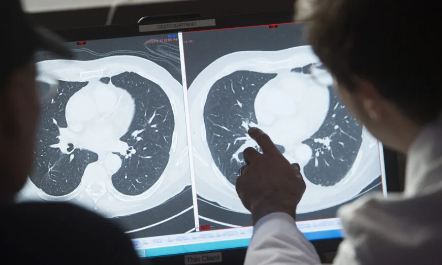 A doctor is seen looking at a CT scan in a file photo (Saul Loeb/AFP via Getty Images)