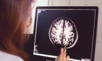 High Levels of HDL Cholesterol Linked to Dementia: Study