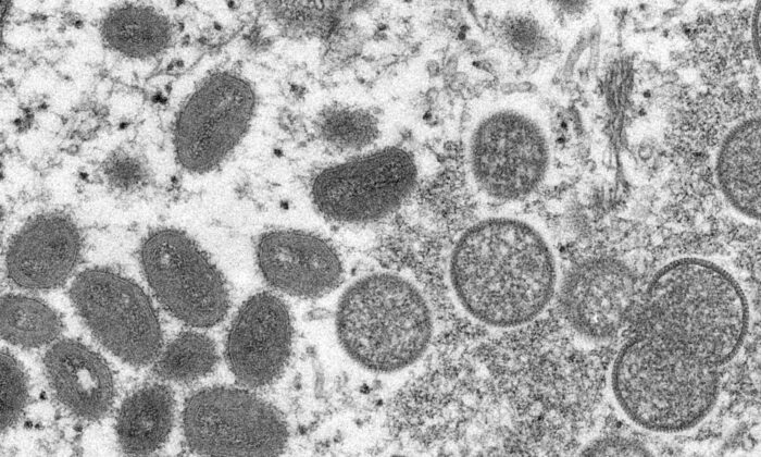 This 2003 electron micrograph provided by the Centers for Disease Control and Prevention is with a mature oval monkeypox virion (left) from a sample of human skin associated with the 2003 prairie dog outbreak. Shows a spherical immature virion (right).  (AP / Cynthia S. Goldsmith, CDC via Russell Regner)