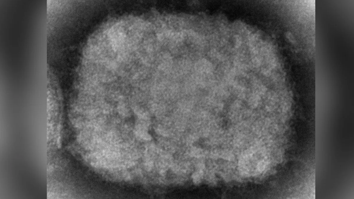 A monkeypox virion, obtained from a clinical sample associated with the 2003 prairie dog outbreak, in an electron microscopic (EM) image. (Cynthia S. Goldsmith/CDC)