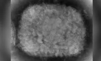 What Is Monkeypox Virus That Is Spreading in Europe, US