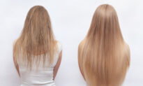 How to Transform Dull, Thinning Hair and Gain Voluminous, Healthy Locks