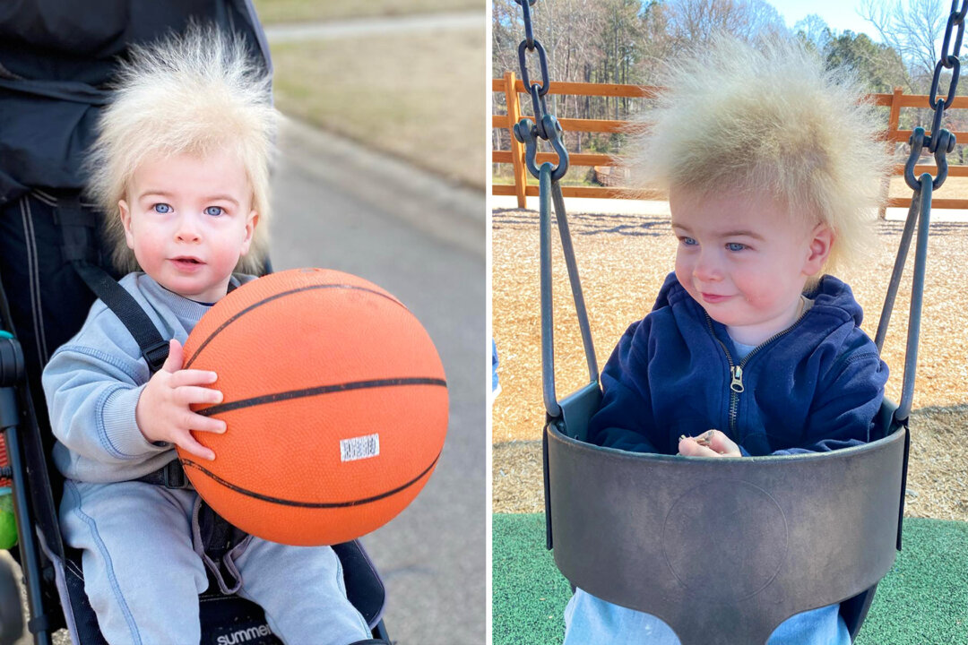 ‘His Hair Is a Blessing’ Boy With Rare Hair Syndrome Brings
