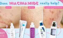 Niacinamide and Panthenol for Reducing Large Pores, Hyperpigmentation, Acne, and More! (ft. Paula’s Choice)