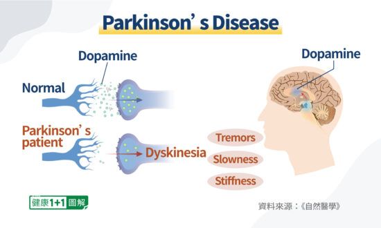 At the Earliest Sign of Parkinson’s Disease, Do This