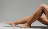 Causes of Spider Veins as We Age, and How to Fix Them