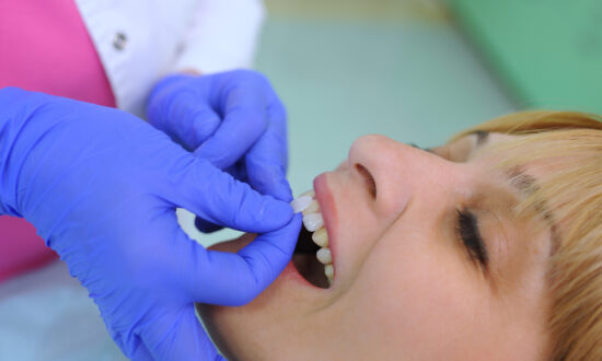 Ask a Dentist: Veneers