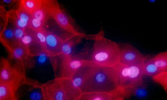 Some Cancer Patients Can Skip Treatments, 2 Studies Show