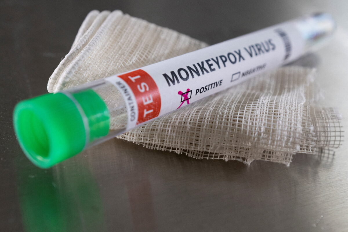 Tube à essai Monkeypox