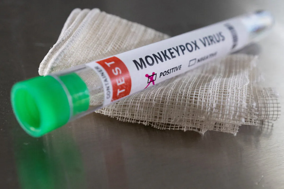 Test tube labelled "Monkeypox virus positive" in a photo illustration taken on May 22, 2022. (Dado Ruvic/Illustration/Reuters)