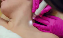 Solutions for Skin Tags