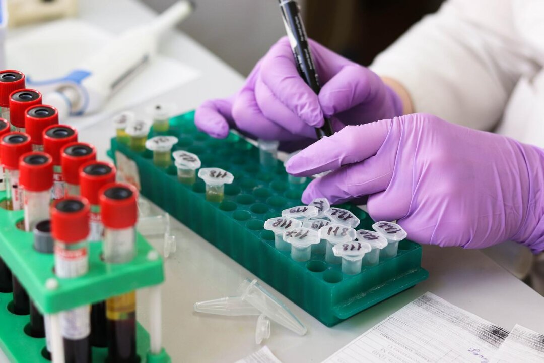 The treatment of hypercoagulability involves helping the body degrade the excessive soluble fibrin it has produced, heal blood vessel damage, and stopping the eitiology of hypercoagulability. (Tatiana Belova)