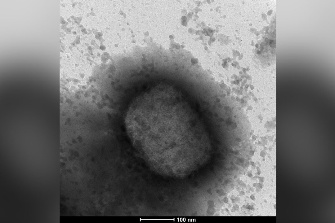 An electronic microscope image shows the monkeypox virus seen by a team from the Arbovirus Laboratory and the Genomics and Bioinformatics Units of the Carlos III Health Institute (ISCIII) in Madrid, May 26, 2022. (The Canadian Press/AP/Unidad de Microscopia Electronica del ISCIII-via)