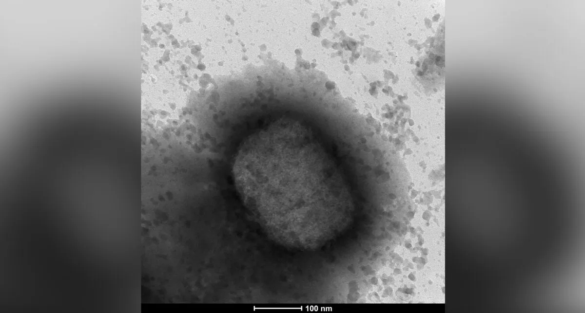 An electronic microscope image shows the monkeypox virus seen by a team from the Arbovirus Laboratory and the Genomics and Bioinformatics Units of the Carlos III Health Institute (ISCIII) in Madrid, May 26, 2022. (The Canadian Press/AP/Unidad de Microscopia Electronica del ISCIII-via)