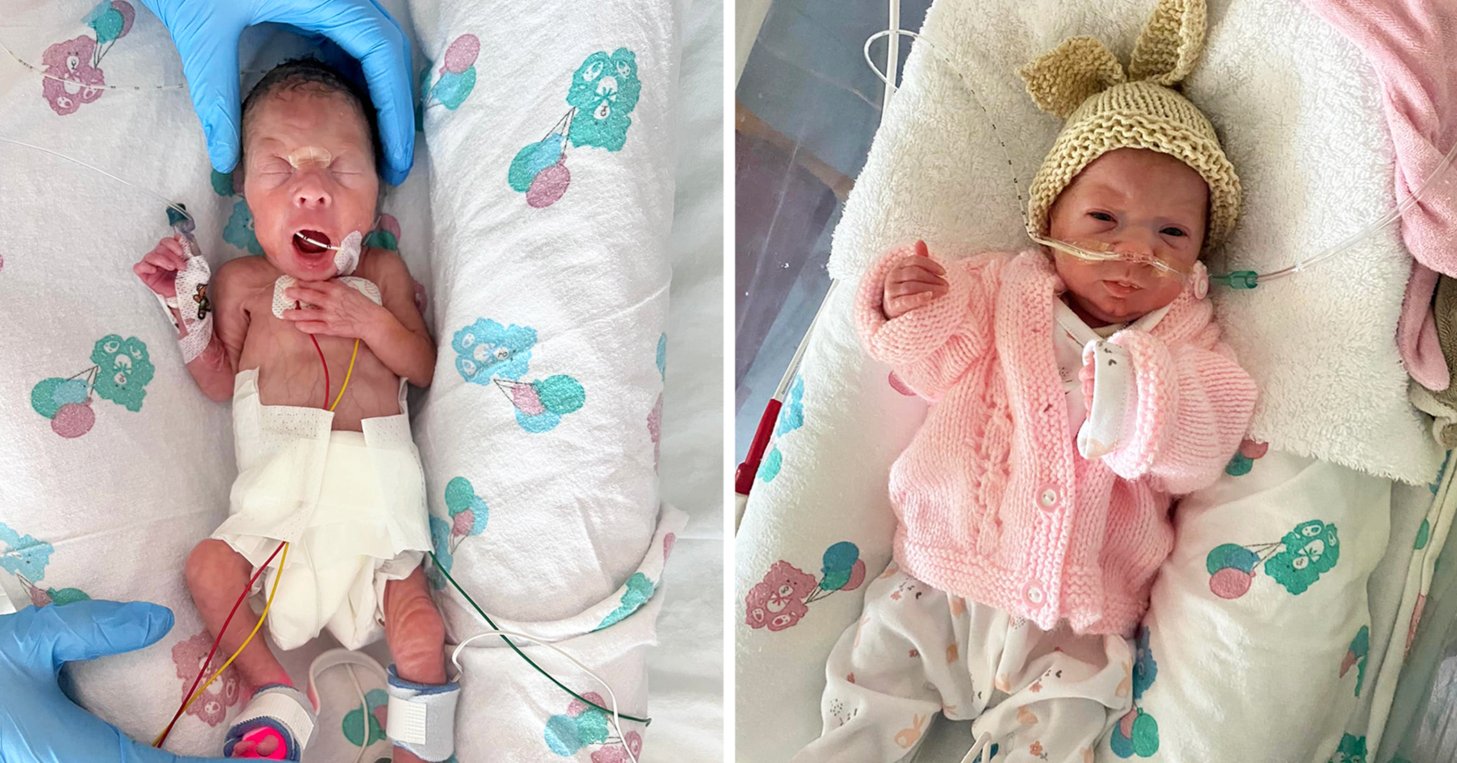 Mom Says Her Preemie Born 14 Weeks Early Is an 'Absolute Miracle and Complete Perfection' - Vimarsana News