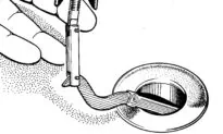 Unclog a Tub Drain