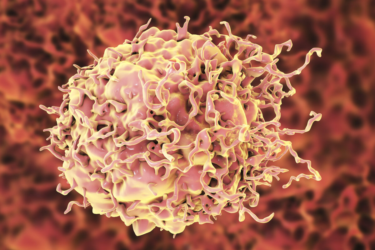Colon cancer cell By Kateryna Kon/Shutterstock