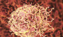 Myeloma, Leukemia, and Other Cancers Linked to COVID: Study