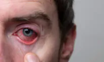 One in Three People Has This Eye Parasite
