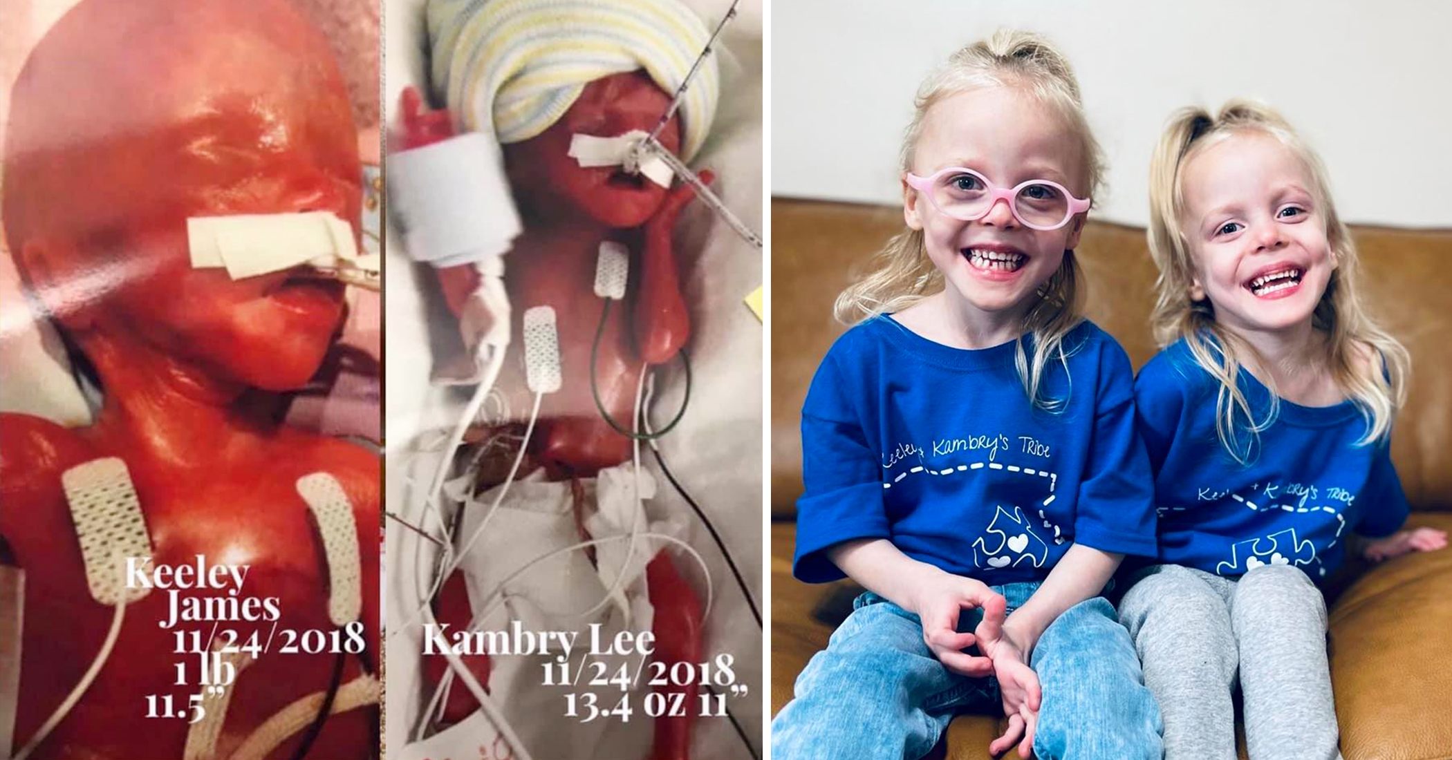 World Record-Holding 'Most Premature Twins' Are Now Happy, Thriving 3-Year-Olds - Vimarsana News