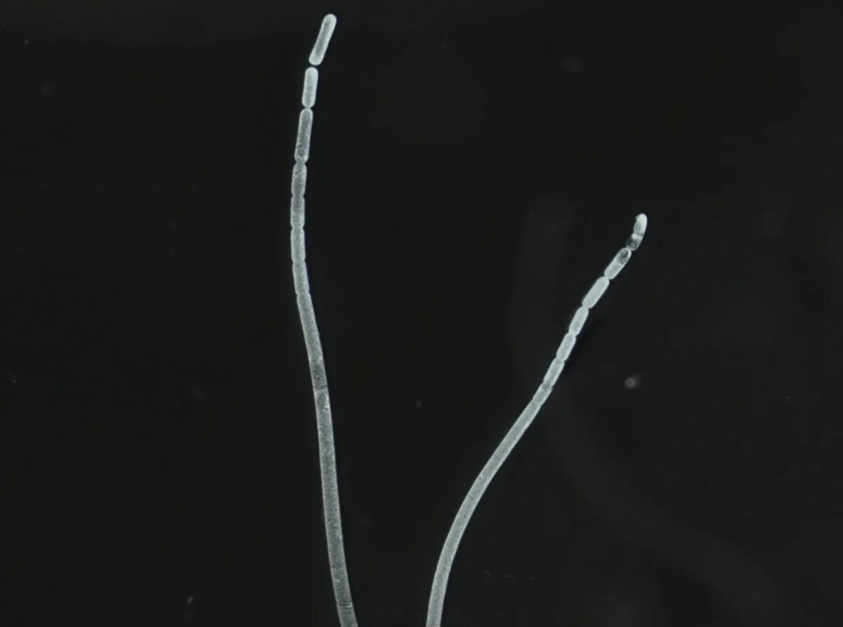 Filaments of the bacterium Thiomargarita magnifica from Guadeloupe, a French archipelago in the Caribbean, in an undated handout image. (Jean-Marie Volland/U.S. Department of Energy's Lawrence Berkeley National Laboratory/Handout via Reuters)