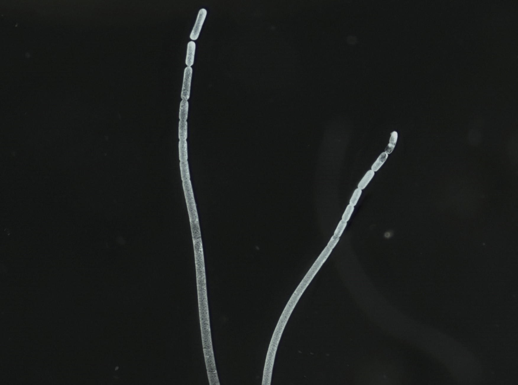 The 'Mount Everest' of Bacteria Discovered in Caribbean Swamps - Vimarsana News
