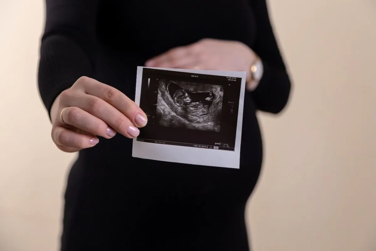 Pregnant woman holding ultrasound picture. (Volodymyr Hryshchenko/Unsplash)