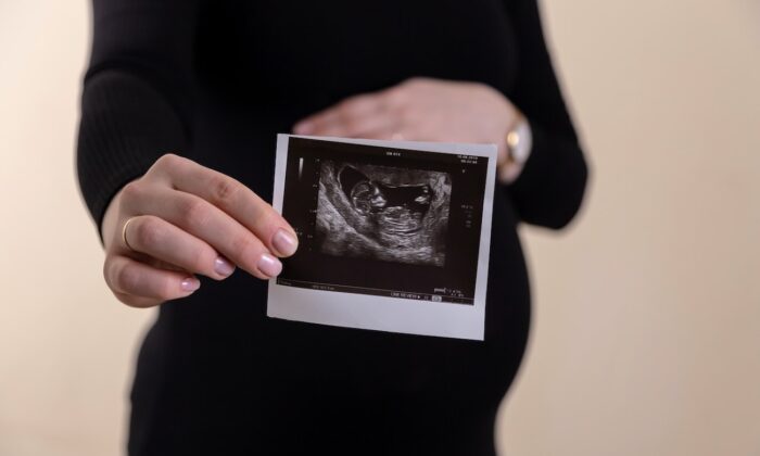 Pregnant woman holding ultrasound picture. (Volodymyr Hryshchenko/Unsplash)