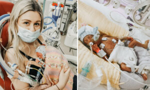 Preemie Born at 23 Weeks and 4 Days Saved by Mom’s Cuddles Defies Odds and Survives