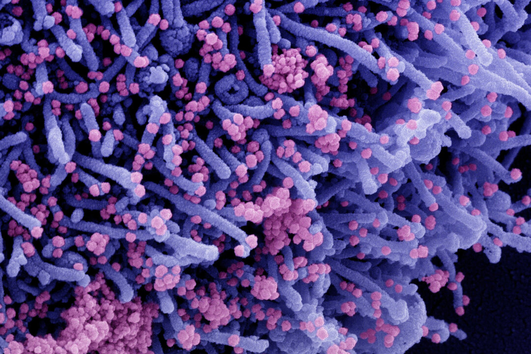 Colorized scanning electron micrograph of a cell (purple) infected with a variant strain of SARS-CoV-2 virus particles (pink), isolated from a patient sample. (NIAID via The Epoch Times)