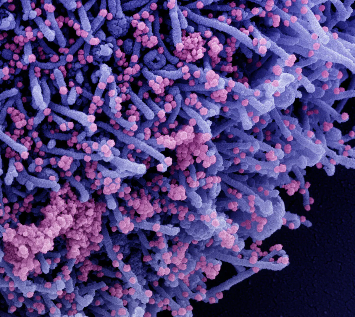 Colorized scanning electron micrograph of a cell (purple) infected with a variant strain of SARS-CoV-2 virus particles (pink), isolated from a patient sample. (NIAID via The Epoch Times)