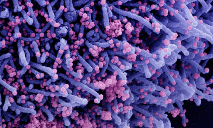 Micrographie électronique à balayage colorisée d'une cellule (violette) infectée par une souche variante de particules de virus SARS-CoV-2 (rose), isolée d'un échantillon de patient. (NIAID via The Epoch Times)