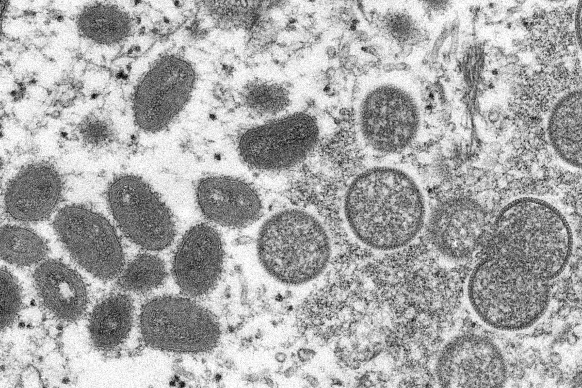 Mature, oval-shaped monkeypox virions (L), and spherical immature virions (R), obtained from a sample of human skin associated with the 2003 prairie dog outbreak. (Cynthia S. Goldsmith, Russell Regner/CDC via AP)