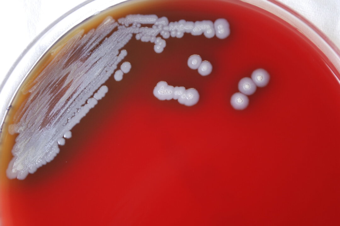 A petri plate containing multiple colonies of Gram-negative Burkholderia pseudomallei bacteria. (Dr. Todd Parker, Audra Marsh/CDC via AP)