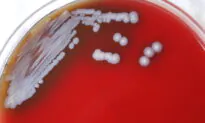 Bacteria That Causes Rare Tropical Disease Found in US Soil