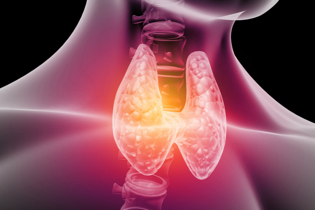 The risk of developing dementia is even higher for people whose condition required thyroid hormone replacement medication, the researchers report. (By Explode/Shutterstock)