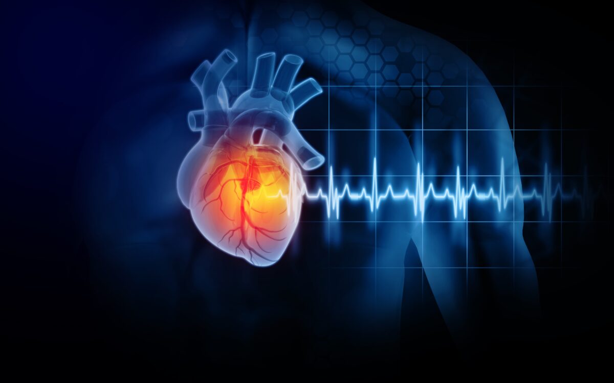 Agir rapidement lorsque vous soupçonnez une crise cardiaque peut sauver une vie. (Par lumière cristalline/Shutterstock)