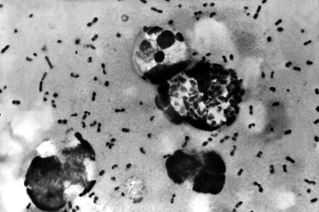 A bubonic plague smear, prepared from a lymph removed from an adenopathic lymph node, or bubo, of a plague patient, demonstrates the presence of the Yersinia pestis bacteria that causes the plague in this undated photo. (Centers for Disease Control and Prevention/Getty Images)