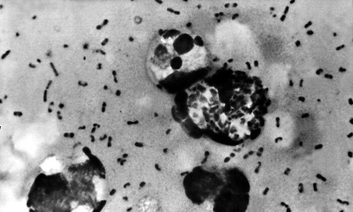 A bubonic plague smear, prepared from a lymph removed from an adenopathic lymph node, or bubo, of a plague patient, demonstrates the presence of the Yersinia pestis bacteria that causes the plague in this undated photo. (Centers for Disease Control and Prevention/Getty Images)