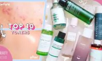 Best Toners for Acne, Hyperpigmentation, Large Pores, Whiteheads, & Blackheads! (Not Sponsored)