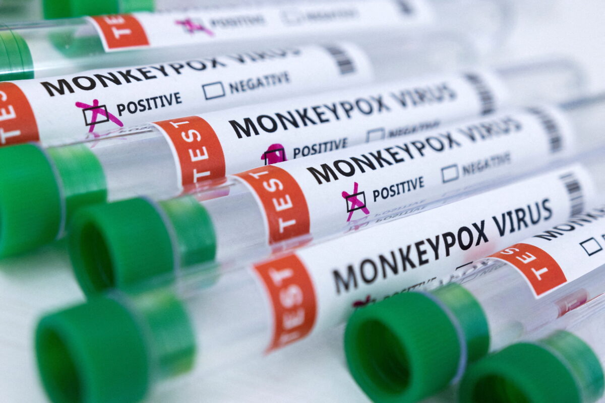 Florida Confirms Its First Case of Child Monkeypox - Vimarsana News