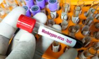Monkeypox Virus: Facts Vs Fear