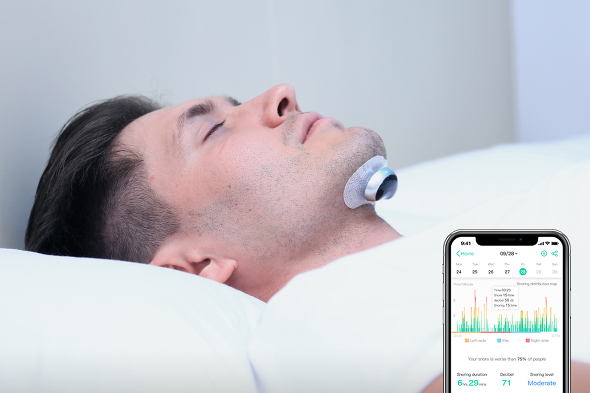 Keep Snoring at Bay with This $80 Gadget - Vimarsana News