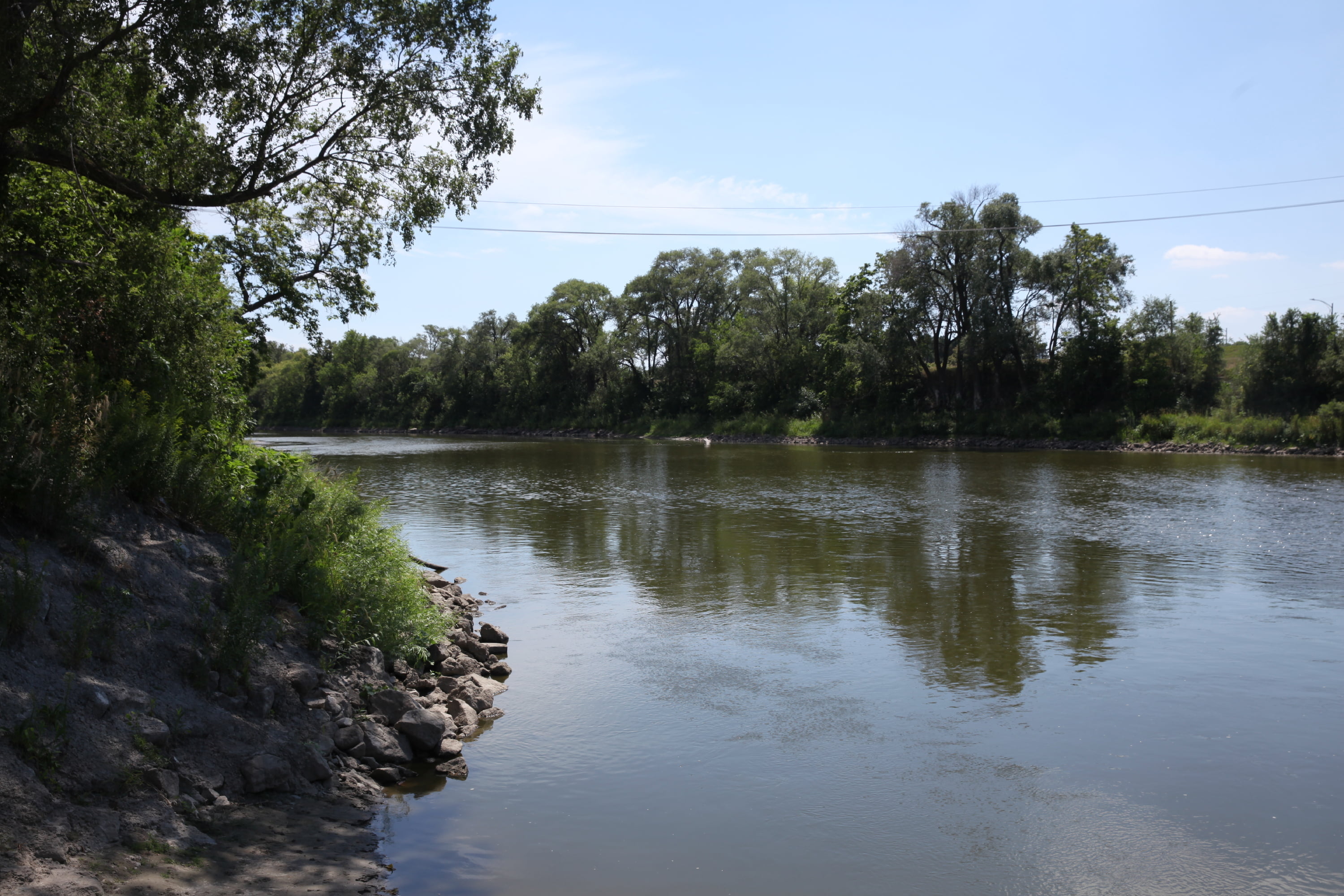 Brain-Eating Amoeba Suspected in 2nd Midwest Death - Vimarsana News