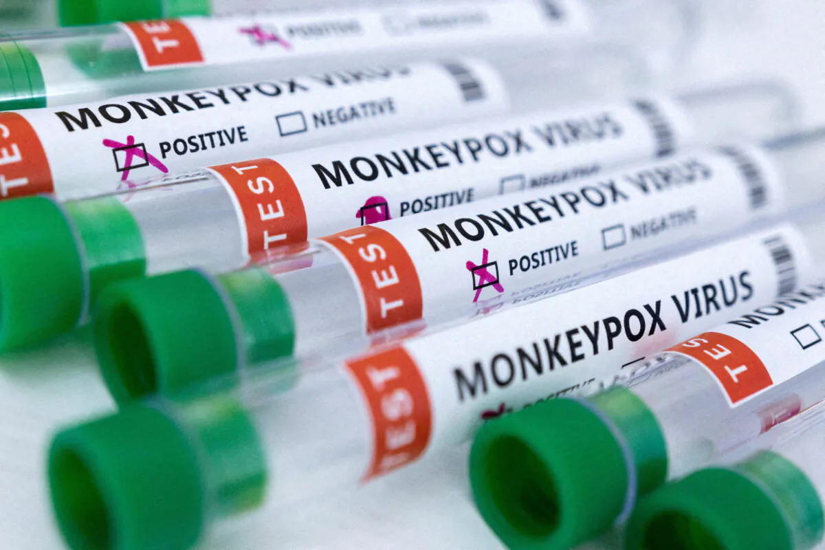 Test tubes labeled "Monkeypox virus positive and negative" are seen in this illustration taken on May 23, 2022. (Dado Ruvic/Illustration/Reuters)